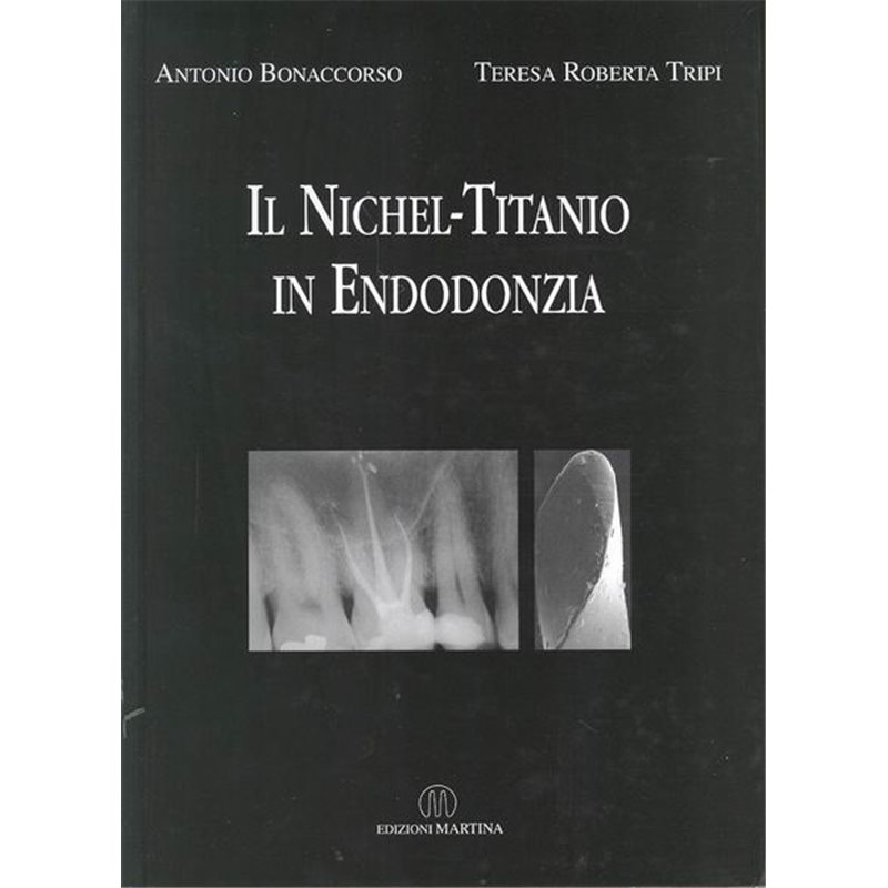 Il Nichel-Titanio in endodonzia